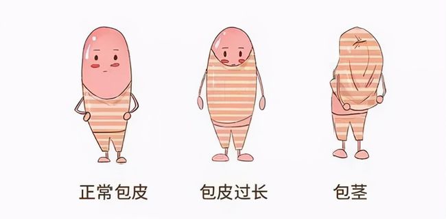 儿童包皮一定要切吗,好博官网